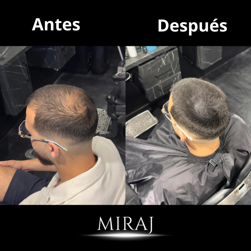 Crema Miraj® | Densidad y Crecimiento Capilar de Forma Natural