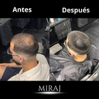 Crema Miraj® | Densidad y Crecimiento Capilar de Forma Natural