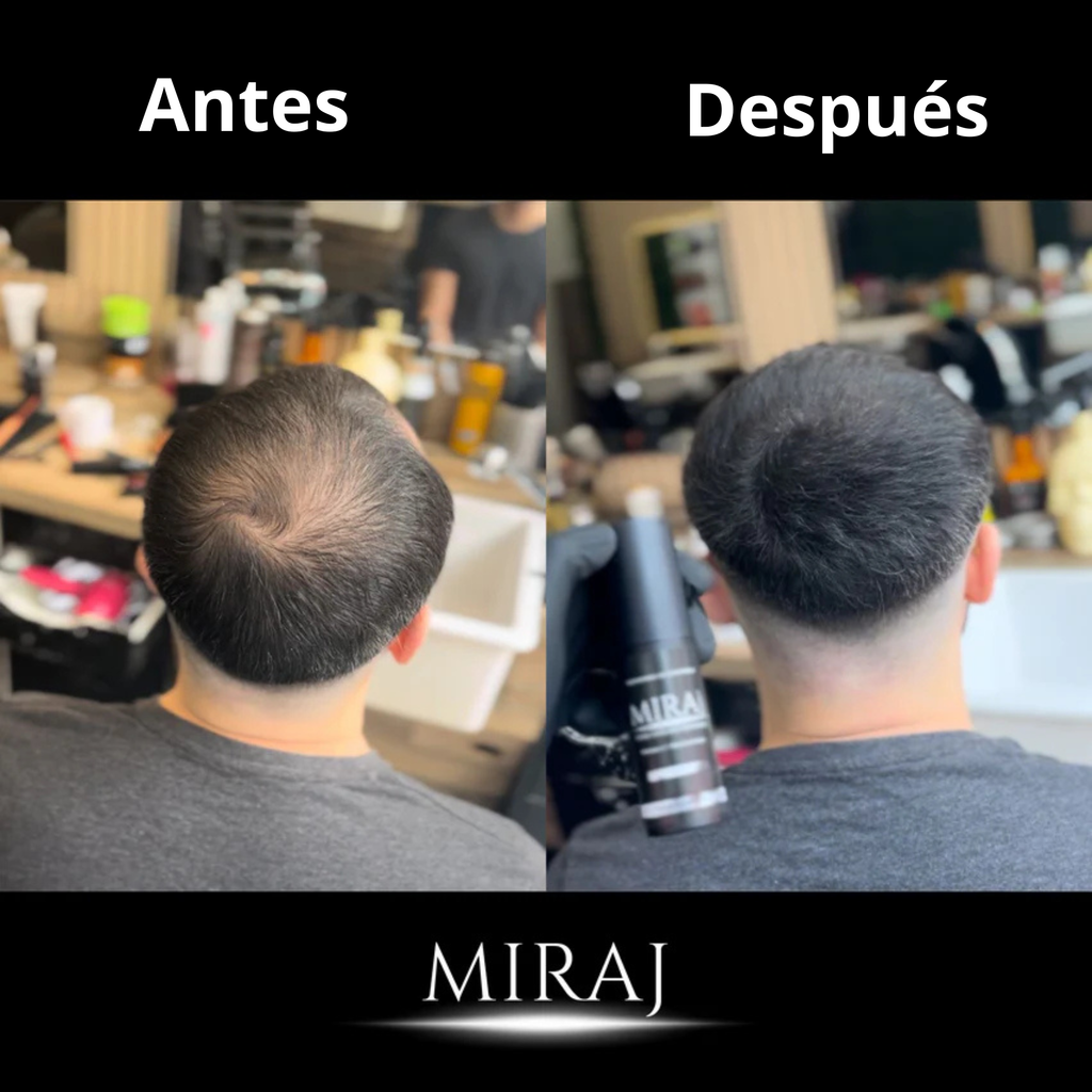 Crema Miraj® | Densidad y Crecimiento Capilar de Forma Natural